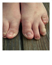 Load image into Gallery viewer, FOOT FETISH - FEET LOVERS PRANK - WITH REAL UGLY FEET POLAROID PHOTOS INCLUDED 😂